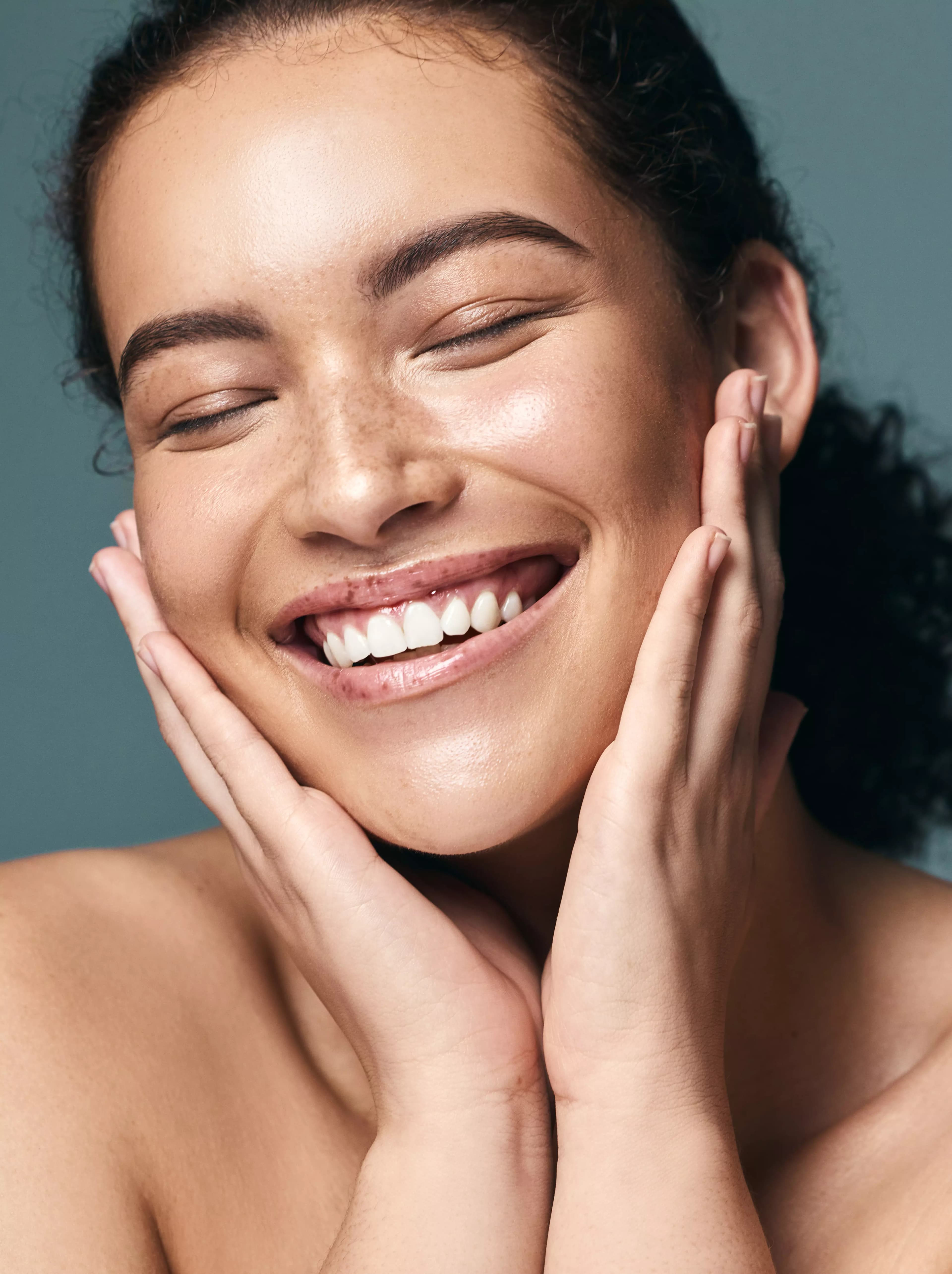 Treating Acne